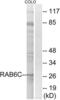 RAB6C, Member RAS Oncogene Family antibody, LS-B9867, Lifespan Biosciences, Western Blot image 