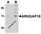 Rho GTPase-activating protein 18 antibody, 5589, ProSci, Western Blot image 