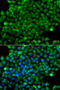 Complement Factor H Related 3 antibody, 14-970, ProSci, Immunofluorescence image 