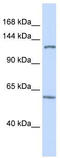 PHD finger protein 12 antibody, TA339654, Origene, Western Blot image 