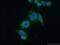 G Protein Subunit Alpha 14 antibody, 13350-1-AP, Proteintech Group, Immunofluorescence image 