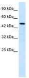 LIM/homeobox protein Lhx9 antibody, TA339514, Origene, Western Blot image 