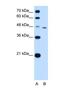 TAP Binding Protein antibody, NBP1-59071, Novus Biologicals, Western Blot image 