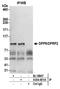 Dipeptidyl Peptidase 9 antibody, A304-851A, Bethyl Labs, Immunoprecipitation image 