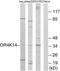 Olfactory Receptor Family 4 Subfamily K Member 14 antibody, PA5-39635, Invitrogen Antibodies, Western Blot image 