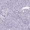 Cellular Repressor Of E1A Stimulated Genes 2 antibody, NBP1-86262, Novus Biologicals, Immunohistochemistry paraffin image 