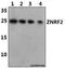 Zinc And Ring Finger 2 antibody, GTX66801, GeneTex, Western Blot image 