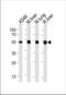 Aldehyde Dehydrogenase 2 Family Member antibody, TA302016, Origene, Western Blot image 
