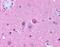 Neuropeptide Y Receptor Y5 antibody, NLS1077, Novus Biologicals, Immunohistochemistry paraffin image 