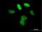 L3MBTL Histone Methyl-Lysine Binding Protein 1 antibody, H00026013-B01P, Novus Biologicals, Immunocytochemistry image 