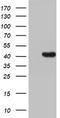 Hydroxymethylbilane Synthase antibody, TA802690S, Origene, Western Blot image 