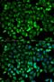 TPX2 Microtubule Nucleation Factor antibody, orb154275, Biorbyt, Immunocytochemistry image 