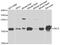 Synuclein Alpha antibody, A7215, ABclonal Technology, Western Blot image 