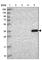 Hydroxysteroid 11-Beta Dehydrogenase 1 antibody, HPA047729, Atlas Antibodies, Western Blot image 