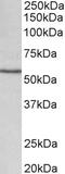 Cytochrome P450 Family 1 Subfamily A Member 1 antibody, STJ72682, St John