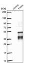 TNFAIP3 Interacting Protein 3 antibody, PA5-60226, Invitrogen Antibodies, Western Blot image 