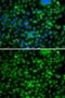 Phytanoyl-CoA Dioxygenase Domain Containing 1 antibody, GTX32791, GeneTex, Immunocytochemistry image 