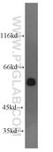 RAD23 Homolog B, Nucleotide Excision Repair Protein antibody, 12121-1-AP, Proteintech Group, Western Blot image 