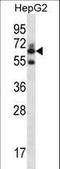 Gamma-Glutamyltransferase 2 antibody, LS-C166460, Lifespan Biosciences, Western Blot image 