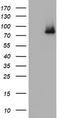 NBS antibody, TA801389AM, Origene, Western Blot image 