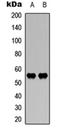 WASP Family Member 3 antibody, orb304661, Biorbyt, Western Blot image 