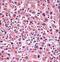 Alkaline Phosphatase, Placental antibody, LS-C156295, Lifespan Biosciences, Immunohistochemistry paraffin image 
