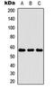Cathepsin K antibody, orb234790, Biorbyt, Western Blot image 