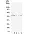 Galectin 8 antibody, R31785, NSJ Bioreagents, Western Blot image 