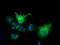 Von Willebrand Factor A Domain Containing 5A antibody, CF501654, Origene, Immunofluorescence image 