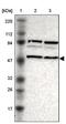 Sorting Nexin 4 antibody, PA5-52188, Invitrogen Antibodies, Western Blot image 