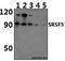 Serine And Arginine Rich Splicing Factor 5 antibody, A06095, Boster Biological Technology, Western Blot image 