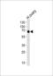 POTE ankyrin domain family member B antibody, MBS9209745, MyBioSource, Western Blot image 