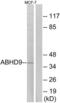 Epoxide Hydrolase 3 antibody, LS-C119685, Lifespan Biosciences, Western Blot image 
