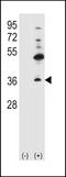 Gap Junction Protein Beta 4 antibody, 58-177, ProSci, Western Blot image 