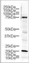 LIM Domain Kinase 1 antibody, GTX10561, GeneTex, Western Blot image 