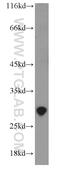 Exosome Component 5 antibody, 15627-1-AP, Proteintech Group, Western Blot image 