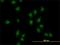 AT-Rich Interaction Domain 1B antibody, H00057492-M02, Novus Biologicals, Immunofluorescence image 