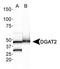 Diacylglycerol O-Acyltransferase 2 antibody, TA336817, Origene, Western Blot image 