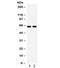 Cell Division Cycle 25B antibody, R32055, NSJ Bioreagents, Western Blot image 