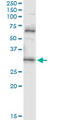 Proenkephalin-B antibody, LS-C197872, Lifespan Biosciences, Immunoprecipitation image 