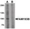 Family With Sequence Similarity 193 Member B antibody, PA5-34440, Invitrogen Antibodies, Western Blot image 