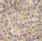 Alpha Fetoprotein antibody, AP11397PU-N, Origene, Immunohistochemistry paraffin image 