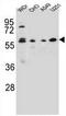 Centrosomal Protein 70 antibody, AP50862PU-N, Origene, Western Blot image 