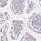 Adenylate Kinase 1 antibody, PA5-52297, Invitrogen Antibodies, Immunohistochemistry paraffin image 