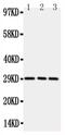 TNF Receptor Superfamily Member 4 antibody, PA5-80164, Invitrogen Antibodies, Western Blot image 