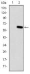 Homeostatic Iron Regulator antibody, GTX60503, GeneTex, Western Blot image 