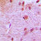 Cbfa1 antibody, LS-C351937, Lifespan Biosciences, Immunohistochemistry paraffin image 