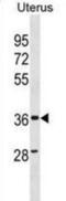 Zinc Finger CCCH-Type Containing, Antiviral 1 Like antibody, abx031186, Abbexa, Western Blot image 