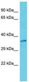 Calmodulin-Lysine N-Methyltransferase antibody, TA330751, Origene, Western Blot image 
