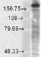 NMDAR2B antibody, MBS800075, MyBioSource, Western Blot image 